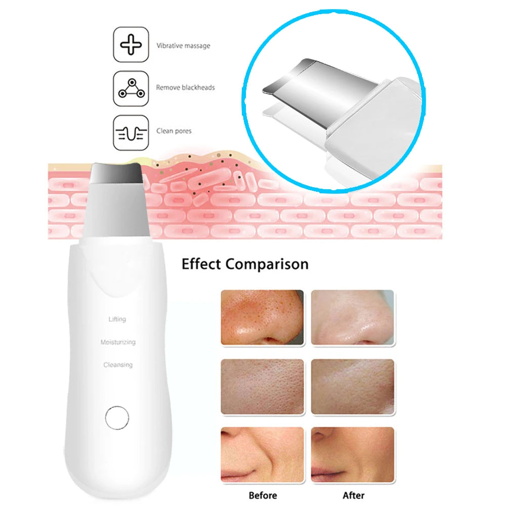 The BloomGlow Ultrasonic Skin Scrubber